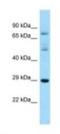 RAS Like Family 12 antibody, NBP1-98570, Novus Biologicals, Western Blot image 