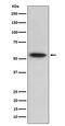 TNF receptor-associated factor 2 antibody, M00400-2, Boster Biological Technology, Western Blot image 