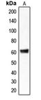 Chloride Channel CLIC Like 1 antibody, orb215073, Biorbyt, Western Blot image 