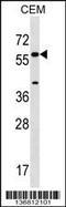 Cytochrome P450 Family 21 Subfamily A Member 2 antibody, 58-893, ProSci, Western Blot image 