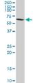 Protein Phosphatase 2 Regulatory Subunit B'Delta antibody, H00005528-M21, Novus Biologicals, Western Blot image 