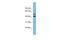 Ankyrin repeat and MYND domain-containing protein 2 antibody, A16611, Boster Biological Technology, Western Blot image 