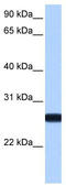 Interleukin 13 Receptor Subunit Alpha 2 antibody, TA337646, Origene, Western Blot image 