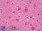 Protein Kinase C Epsilon antibody, LS-B7689, Lifespan Biosciences, Immunohistochemistry paraffin image 