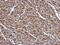 Rab Geranylgeranyltransferase Subunit Beta antibody, GTX105874, GeneTex, Immunohistochemistry paraffin image 