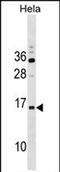 Ribonuclease P/MRP Subunit P14 antibody, PA5-72106, Invitrogen Antibodies, Western Blot image 