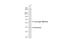 Transmembrane Serine Protease 2 antibody, GTX100743, GeneTex, Western Blot image 