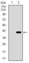 Integrin Subunit Alpha 2b antibody, GTX60764, GeneTex, Western Blot image 