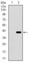 Integrin Subunit Alpha 2b antibody, GTX60764, GeneTex, Western Blot image 