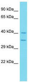 Aspartate Beta-Hydroxylase Domain Containing 1 antibody, TA334826, Origene, Western Blot image 