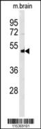 Neuronal Pentraxin 1 antibody, 62-785, ProSci, Western Blot image 