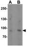 FCH Domain Only 2 antibody, GTX31483, GeneTex, Western Blot image 