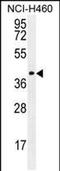 Coiled-Coil Domain Containing 54 antibody, PA5-48208, Invitrogen Antibodies, Western Blot image 