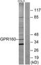 G Protein-Coupled Receptor 160 antibody, A14818, Boster Biological Technology, Western Blot image 