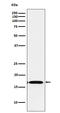 Fibroblast Growth Factor 1 antibody, M00206-1, Boster Biological Technology, Western Blot image 