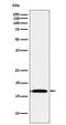 FGF1 antibody, M00206-1, Boster Biological Technology, Western Blot image 