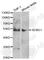 Semenogelin 1 antibody, A5487, ABclonal Technology, Western Blot image 