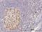 Cyclin Dependent Kinase 1 antibody, H00000983-M04, Novus Biologicals, Immunohistochemistry paraffin image 