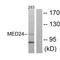 Mediator Complex Subunit 24 antibody, A05987, Boster Biological Technology, Western Blot image 