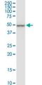 CCR4-NOT Transcription Complex Subunit 2 antibody, H00004848-M08, Novus Biologicals, Western Blot image 