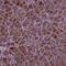 AP-5 complex subunit beta-1 antibody, NBP2-49531, Novus Biologicals, Immunohistochemistry paraffin image 