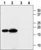 Potassium Voltage-Gated Channel Subfamily E Regulatory Subunit 3 antibody, TA328636, Origene, Western Blot image 