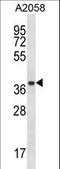 Proteasome Subunit Alpha 1 antibody, LS-C162215, Lifespan Biosciences, Western Blot image 