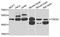 TRNA Splicing Endonuclease Subunit 2 antibody, A7838, ABclonal Technology, Western Blot image 