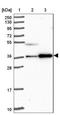 Coiled-Coil Domain Containing 137 antibody, NBP2-31033, Novus Biologicals, Western Blot image 