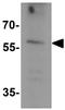 Solute Carrier Family 29 Member 4 antibody, GTX31614, GeneTex, Western Blot image 