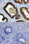 Tumor Protein P63 antibody, BAF1916, R&D Systems, Western Blot image 
