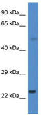 Cytochrome P450 Family 1 Subfamily B Member 1 antibody, TA339934, Origene, Western Blot image 