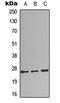 Complement C1q B Chain antibody, LS-C358924, Lifespan Biosciences, Western Blot image 