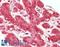 Proteasome Subunit Alpha 1 antibody, LS-B14879, Lifespan Biosciences, Immunohistochemistry paraffin image 