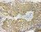 Haptoglobin antibody, PA1599, Boster Biological Technology, Immunohistochemistry paraffin image 