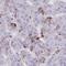 Ankyrin Repeat Domain 60 antibody, HPA060561, Atlas Antibodies, Immunohistochemistry frozen image 