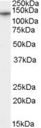 Calcium Voltage-Gated Channel Auxiliary Subunit Alpha2delta 1 antibody, EB07832, Everest Biotech, Western Blot image 