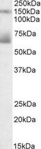 Mesothelin antibody, GTX88160, GeneTex, Western Blot image 