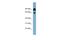 CRR9 antibody, A03334, Boster Biological Technology, Western Blot image 