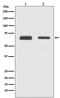 Cell Division Cycle 23 antibody, M05798, Boster Biological Technology, Western Blot image 