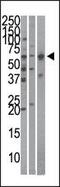 Importin subunit alpha-4 antibody, PA5-11810, Invitrogen Antibodies, Western Blot image 