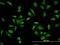 SH3 Domain Binding Protein 5 antibody, H00009467-M01, Novus Biologicals, Immunocytochemistry image 