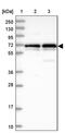 Trophinin Associated Protein antibody, PA5-60613, Invitrogen Antibodies, Western Blot image 