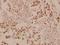 Patched 1 antibody, A00441, Boster Biological Technology, Immunohistochemistry frozen image 