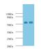 Matrix Metallopeptidase 12 antibody, LS-C317642, Lifespan Biosciences, Western Blot image 