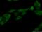 Heterogeneous Nuclear Ribonucleoprotein F antibody, 14974-1-AP, Proteintech Group, Immunofluorescence image 