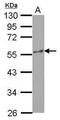 Katanin Catalytic Subunit A1 antibody, PA5-31498, Invitrogen Antibodies, Western Blot image 