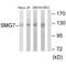 SMG7 Nonsense Mediated MRNA Decay Factor antibody, A06078, Boster Biological Technology, Western Blot image 