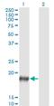 Prostate Stem Cell Antigen antibody, H00008000-M03, Novus Biologicals, Western Blot image 