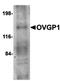 Mitogen-Activated Protein Kinase Kinase 6 antibody, orb6579, Biorbyt, Western Blot image 